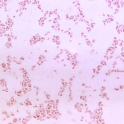 Gut Microbiota Dybiosis May Be Linked to Rheumatic Disease