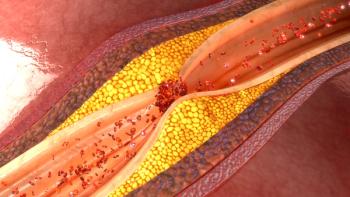 Antithrombosis for Secondary Prevention of Coronary Artery Disease