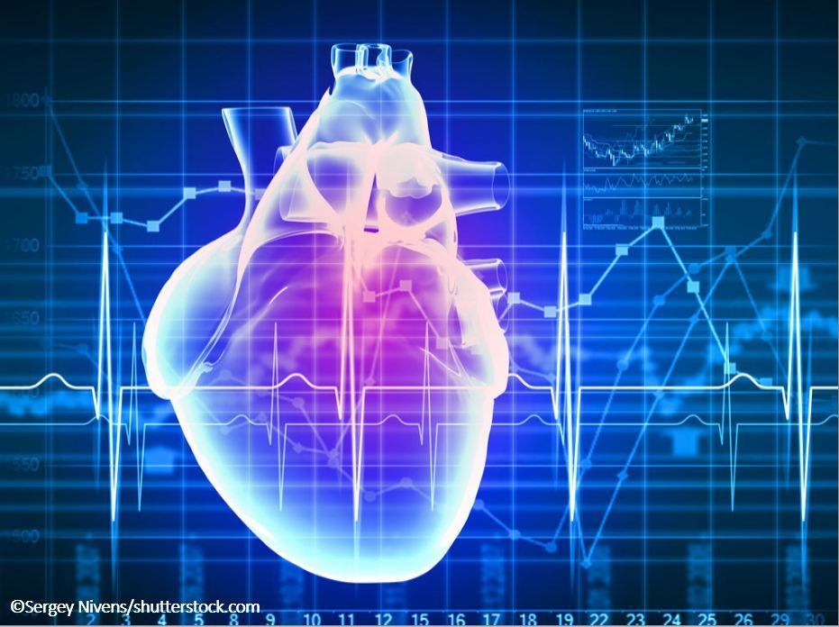heart electrocardiogram lupus cardiomyopathy