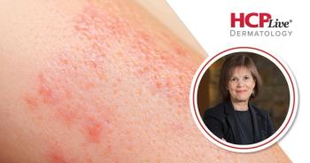 No Signal for Birth Defects in Dupilumab Pregnancy Registry, With Tina Chambers, PhD, MPH