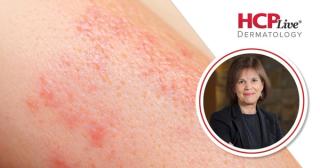 No Signal for Birth Defects in Dupilumab Pregnancy Registry, With Tina Chambers, PhD, MPH