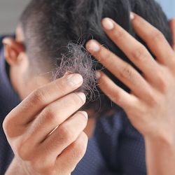 Ankylosing Spondylitis Not Linked to Increased Risk of Alopecia 
