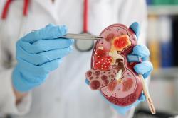 FAQ: Understanding New ESC/ERA Guideline on Cardiovascular Disease and Chronic Kidney Disease
