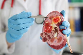 Doctor explaining kidney disease using a 3D model. | Credit: Adobe Stock