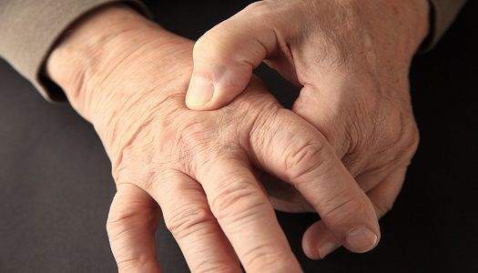 Stock image depicting an older person experiencing joint stiffness from rheumatoid arthritis