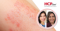Tips for Clinicians Diagnosing Patients with Diverse Skin Types