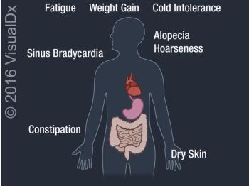 Visual Dx: Weight Gain, Fatigue, and Cold Sensitivity ...Can You Diagnose This