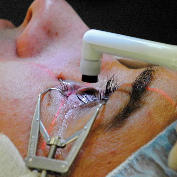 Cataract Surgery Increases Risk Of Diabetic Retinopathy