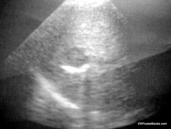 Abdominal imaging of patient featured in the case report. | Credit: Brady Pregerson, MD