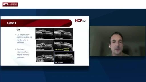 Emerging Approaches in AMD and DME: A Case-Based Discussion