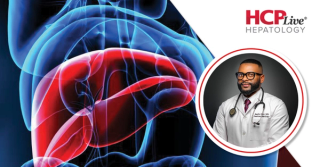 Optimizing MASLD Screening in the Era of Liver-Directed Therapy