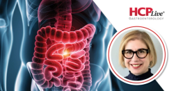 HRQoL, Treatment Satisfaction With Risakizumab in ASPIRE-CD, With Laurie Keefer, PhD