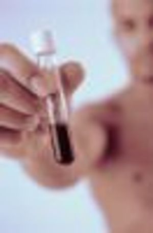 Exploring the Role of the Immune System in Lyme Disease