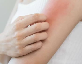 Credit: Adobe Stock/ KMPZZZ