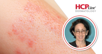 Delphine Kerob, MD | Image credit: Global Dermatology