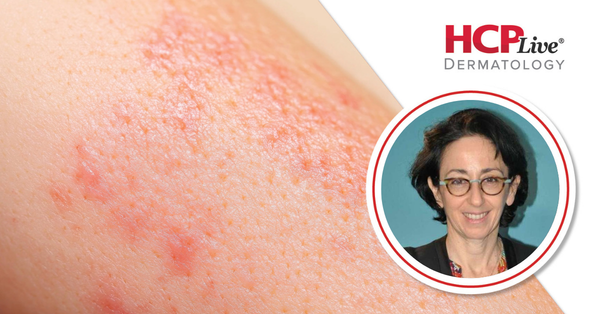 Delphine Kerob, MD | Image credit: Global Dermatology