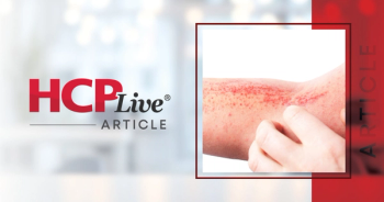 EADV 2026: Tilrekimig Achieves EASI-75 Across All Doses in Atopic Dermatitis