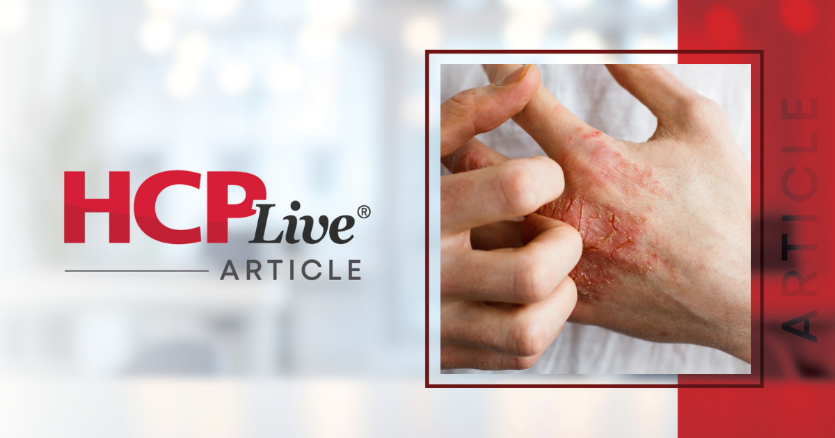 Nemolizumab Data at RAD 2026 Shed Light on Long-Term Itch Control, Pediatric Benefit