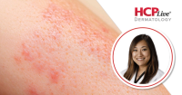 Diagnostic Pearls and New Therapies in Connective Tissue Disease, With Michelle Min, MD