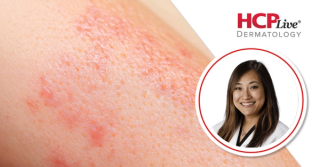 Key Diagnostic and Therapeutic Pearls for Connective Tissue Disease, With Michelle Min, MD
