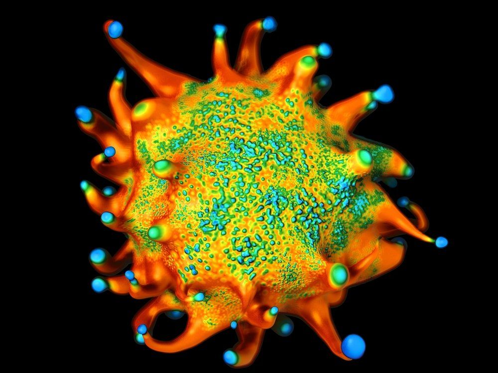 Cervical Cancer, Hodgkin Lymphoma Increase ASCVD Risk
