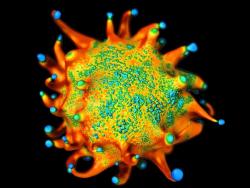 Cervical Cancer, Hodgkin Lymphoma Increase ASCVD Risk