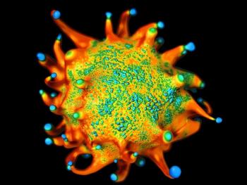 Cervical Cancer, Hodgkin Lymphoma Increase ASCVD Risk