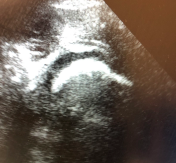 Ultrasound imagery. | Credit: Brady Pregerson