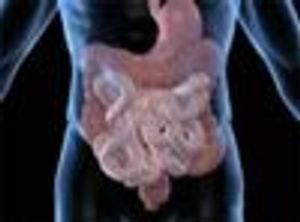 Does Choice of Bowel Preparation Method Affect Hyponatremia Risk in Older Patients Readying for Colonoscopy?