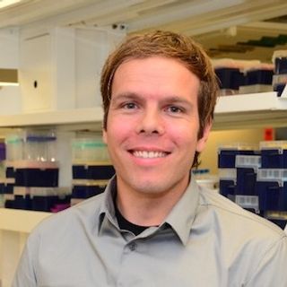 Ward Fickweiler, MD, PhD: Diabetic Retinopathy Inversely Associated with AMD