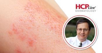 New Therapeutic Options in Cutaneous Oncology for 2026, With Paul Nghiem, MD, PhD