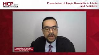 Presentation of Atopic Dermatitis in Adults and Pediatrics