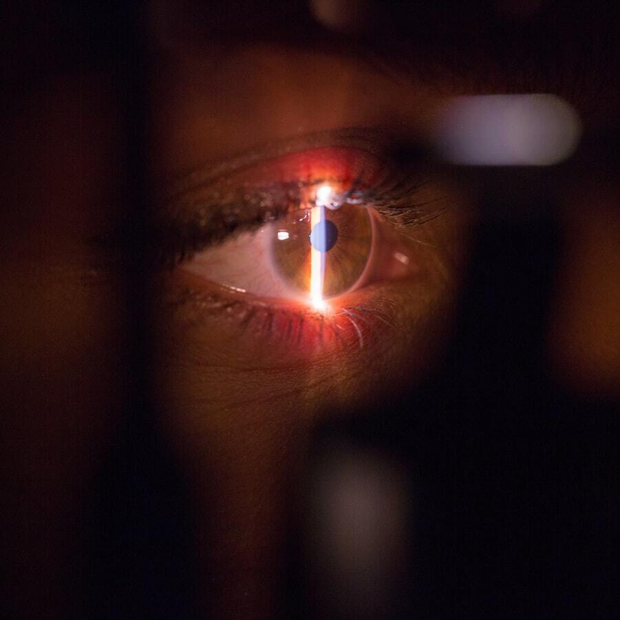 diabetic retinopathy