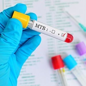 Tuberculosis Associated with Worsened Patient Mortality Post-Treatment