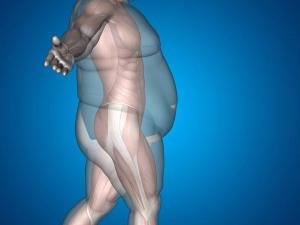 Dementia Tied to Late-in-Life Weight Gain and Loss