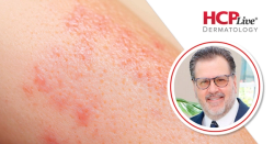 Key Diagnostic and Therapeutic Pearls in Dermatology, With Brad P. Glick, DO, MPH