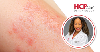 Addressing Complex Cases in Dermatology at SOCS Scientific Symposium, With Janiene Luke, MD