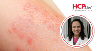 Guidelines on Genetic Disorders of the Skin and Pediatric Patients, With Yasmine Kirkorian, MD