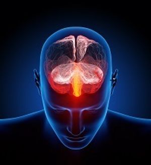  Myelination Problems Linked to Migraines
