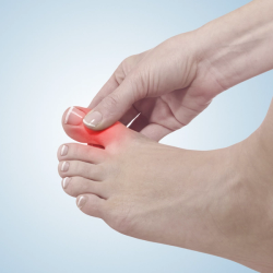 Jeff Peterson, MD, on Reframing Gout as a Chronic Disease