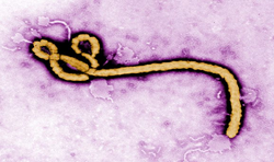 Ebola Vaccines Provide Year-Long Immune Response