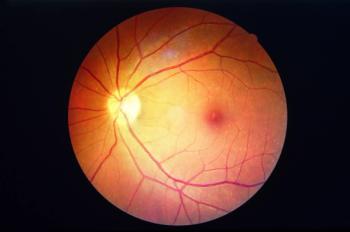 Diabetes Retinopathy, (©AdobeStock_Koolsabuy)