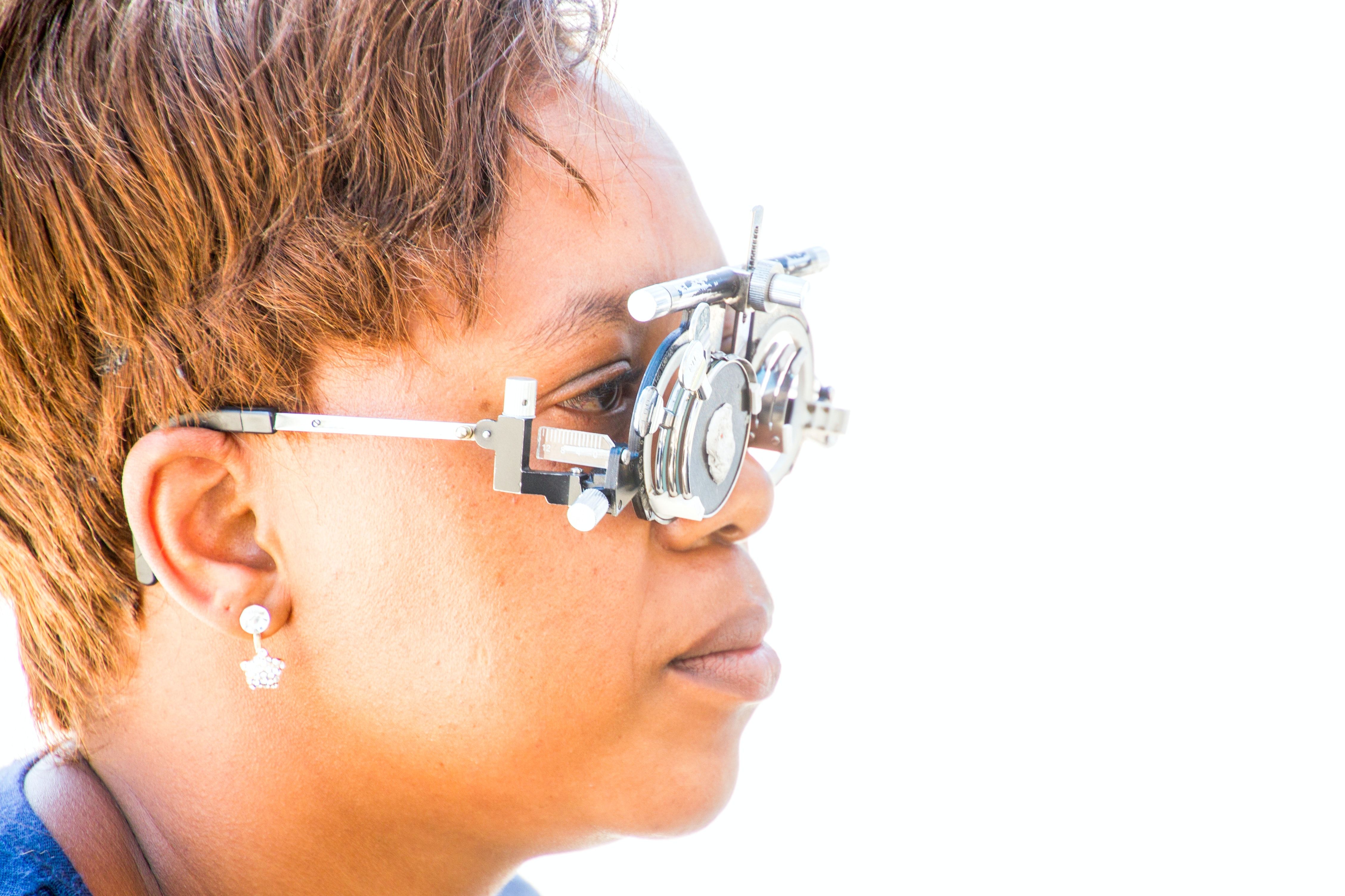 Tailored Aflibercept Improves Long-Term BRVO Macular Edema Vision