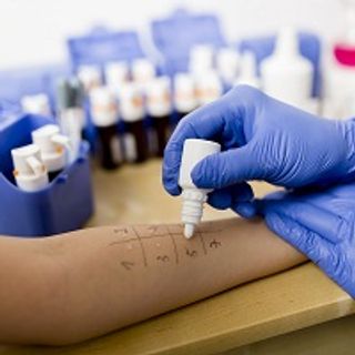 Skin's Immune Profile Bolsters Benefits of Potential Peanut Allergy Patch