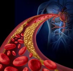 Low Testosterone in Diabetic Men Linked to Advanced Markers of Cardiovascular Disease