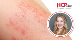 Tips on Advising Dermatology Patients on Diet and Lifestyle Choices, With Heather Goff, MD, MPH