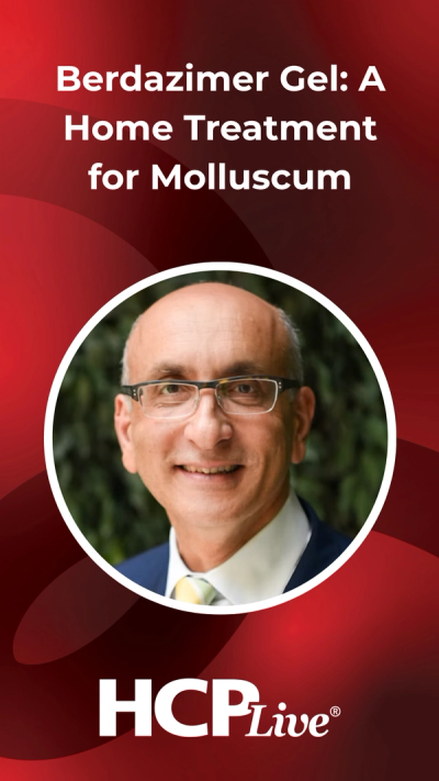 Berdazimer Gel: A Home Treatment for Molluscum