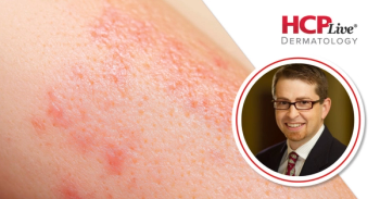Antibiotic Stewardship in Dermatology: A Call to Prescribe Less