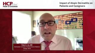 Impact of Atopic Dermatitis on Patients and Caregivers