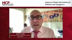 EP. 2 Impact of Atopic Dermatitis on Patients and Caregivers